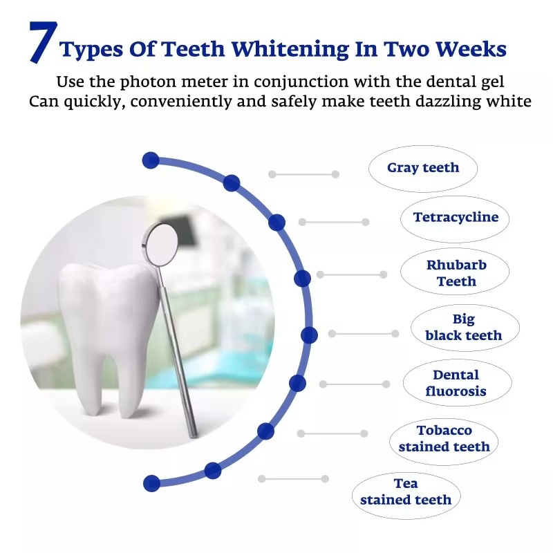 Intelligent LED Blue Light Por - Teeth Whitening Tray 评论和价格