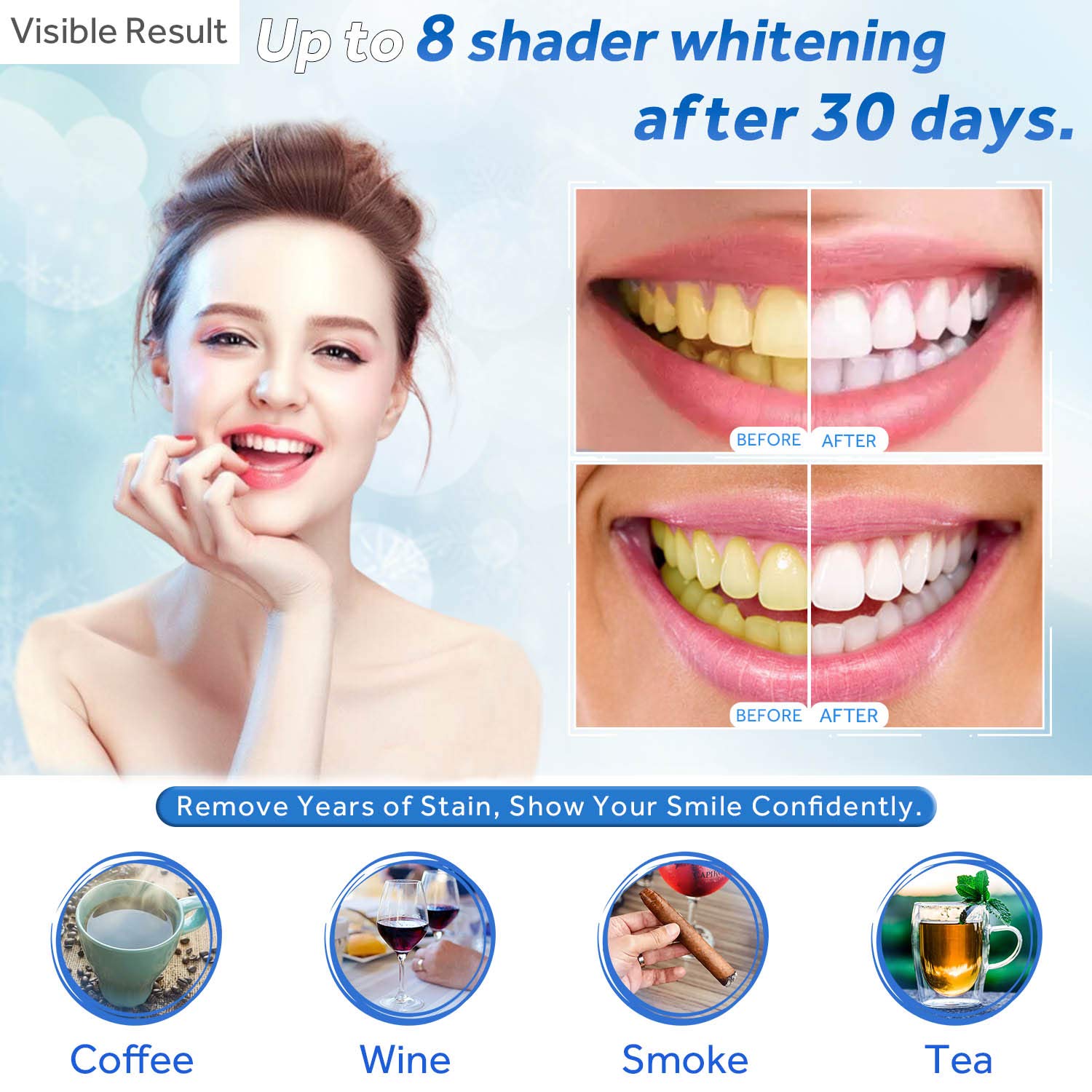 Teeth Whitening Gel Refill Syr - Teeth Whitening Shade Guide 评论和价格