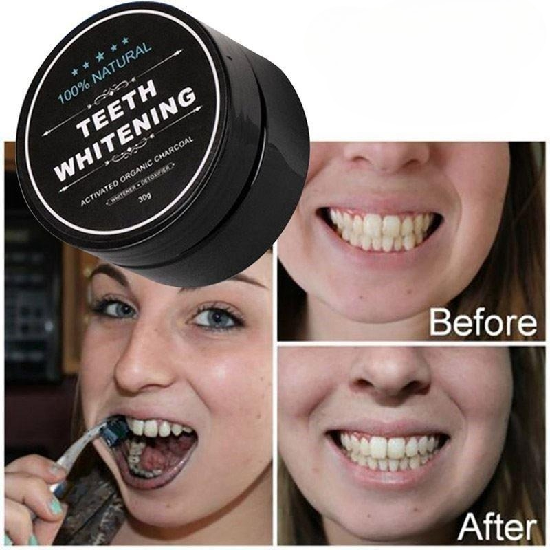 1 Box Activated Charcoal Teeth - Teeth Whitening Ingredients 评论和价格